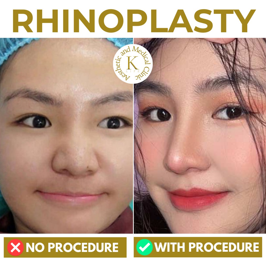 K Aesthetic and Medical Clinic Facebook ad