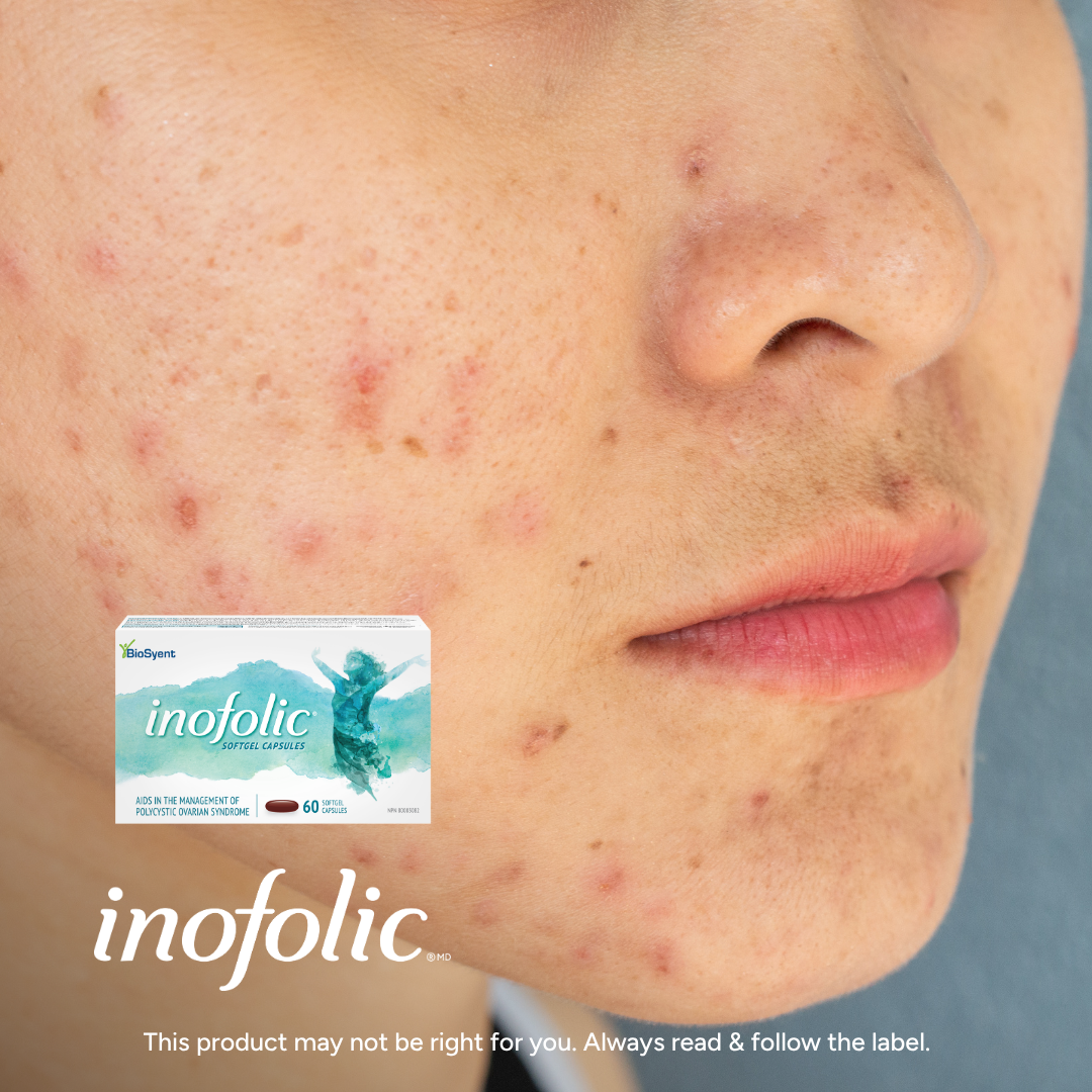 Inofolic Canada Facebook ad