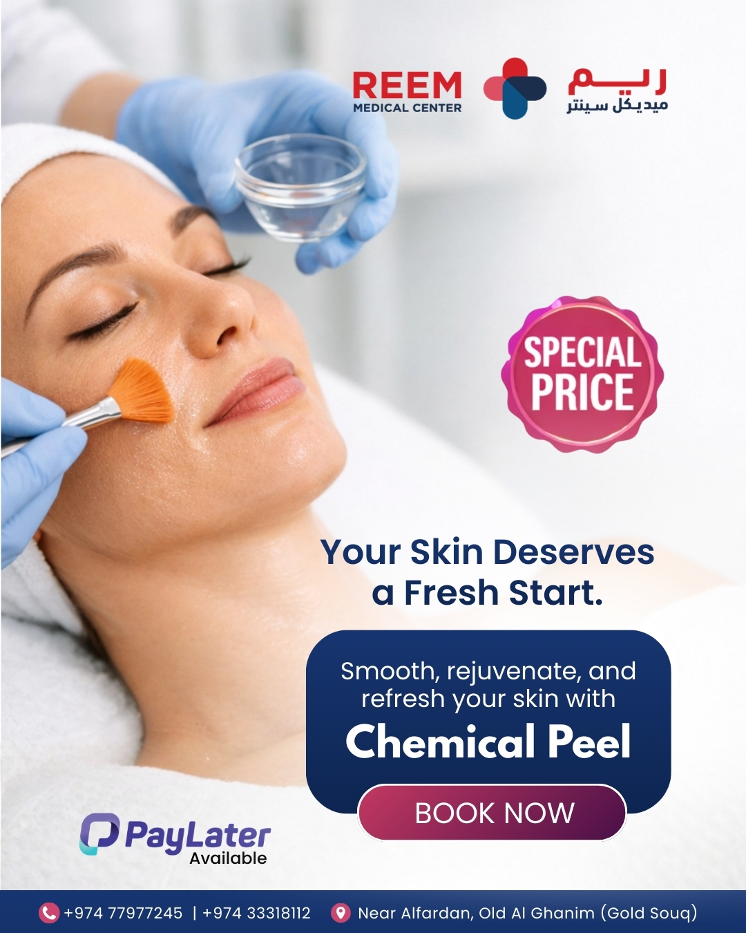 Reem Medical Center Facebook ad: Glow with a Professional Chemical Peel