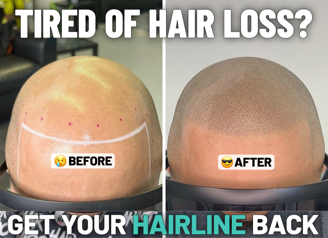 DNA Style Facebook ad: Choose Permanent Results