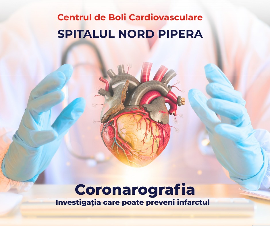 Grupul Medical NORD Facebook ad from Jul 29, 2025