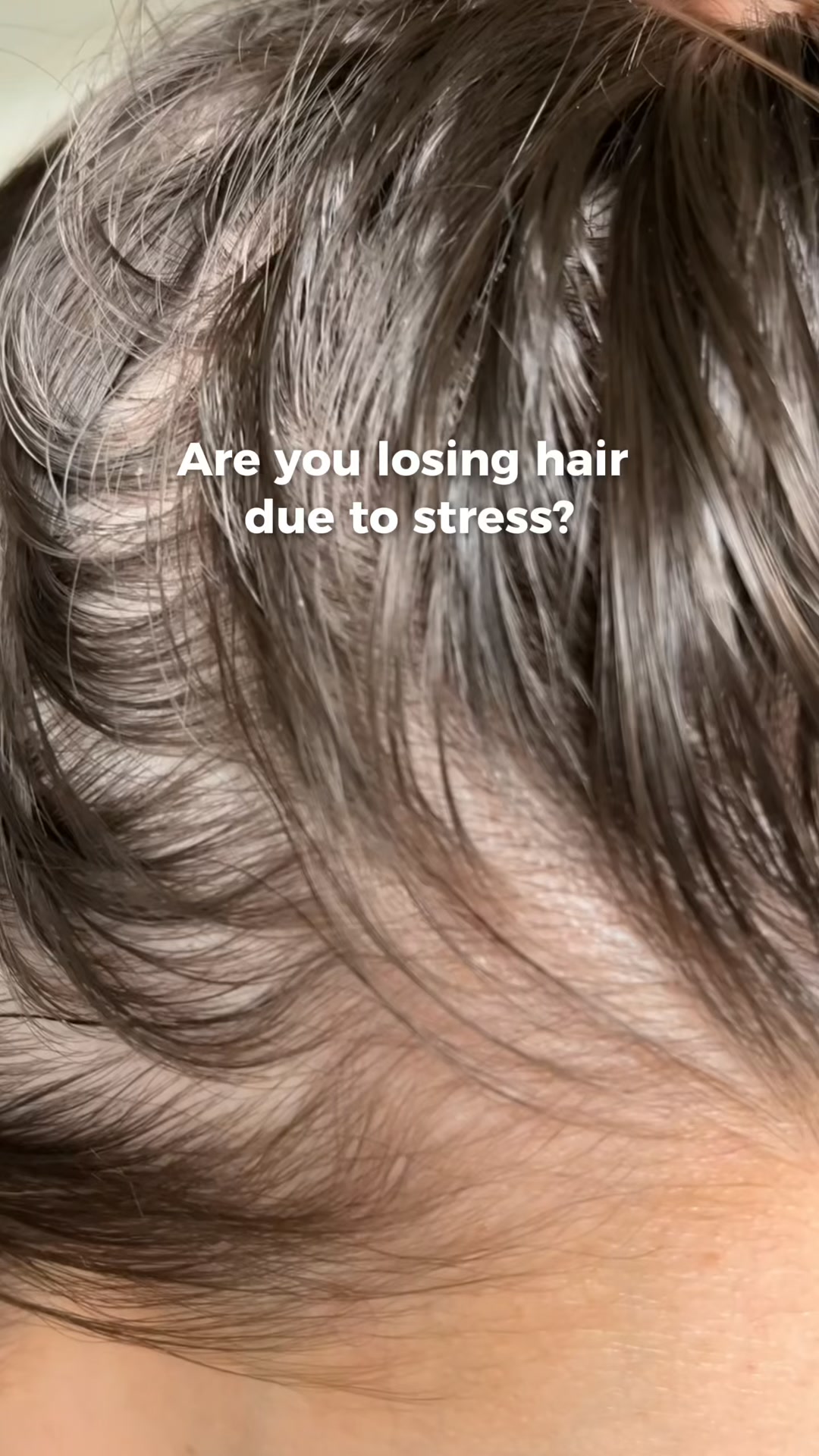 HINU Facebook ad: When stress shows up in your hair