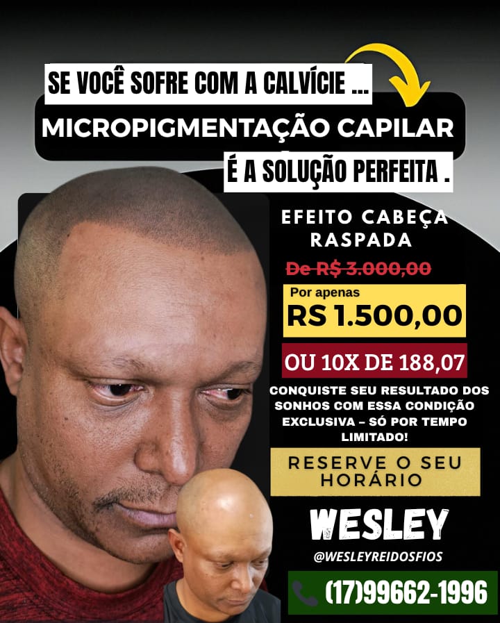Wesley Rei dos Fios Facebook ad: Fale Comigo!