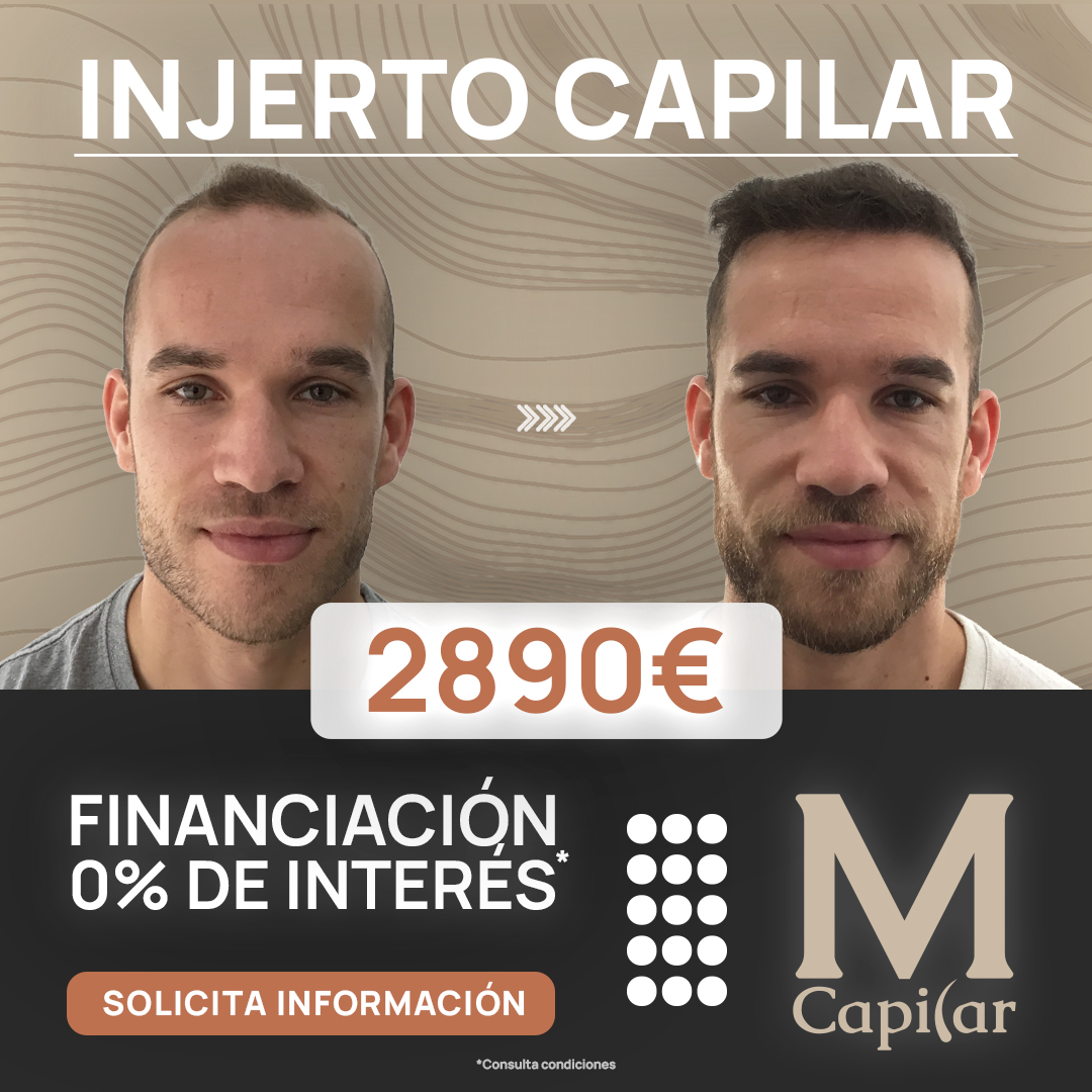 MCapilar Facebook ad