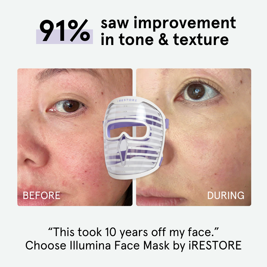 iRESTORE Skincare Facebook ad