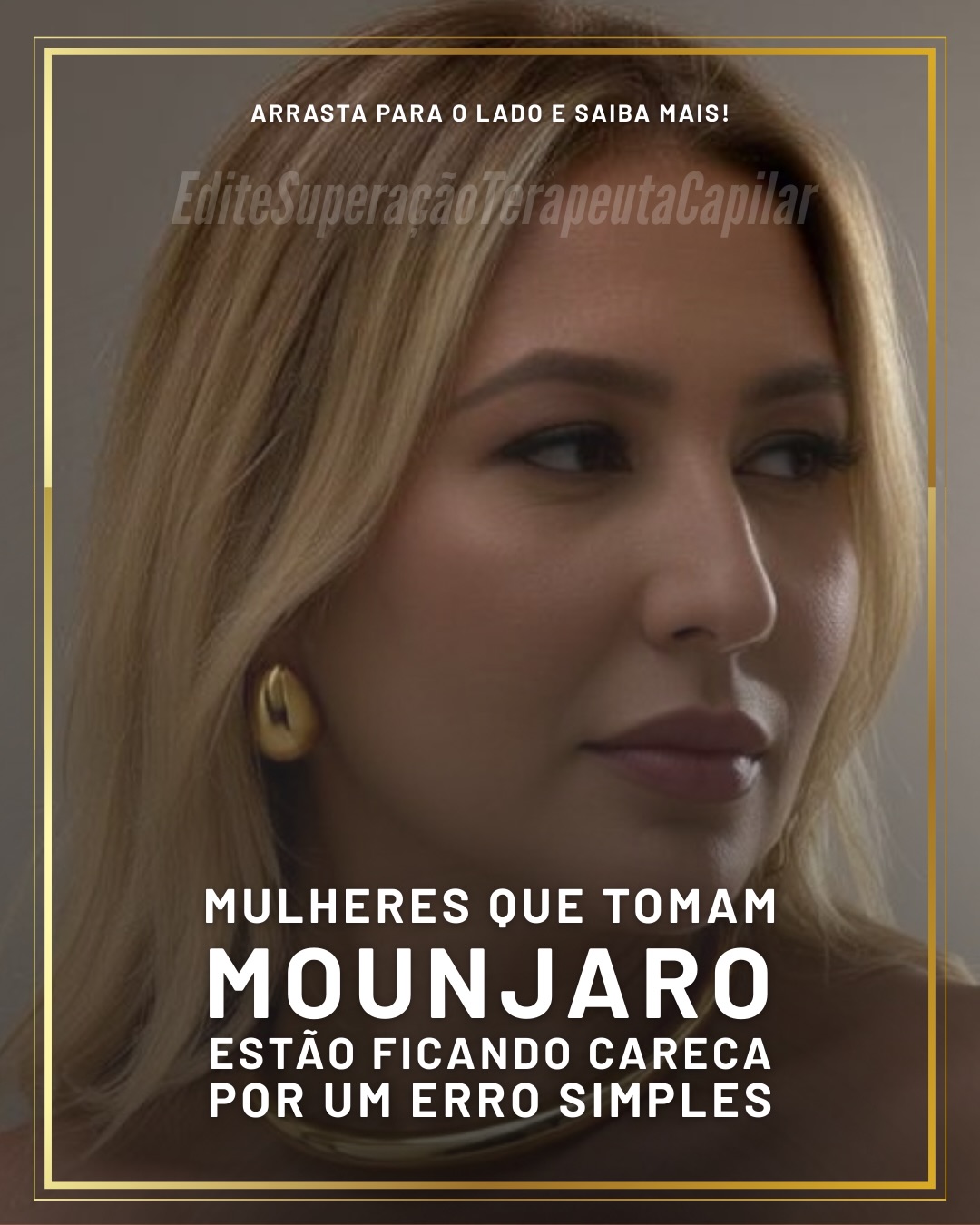 Centro de Beleza e Recuperação Capilar Facebook ad: Queda de cabelo é sinal de estresse metabólico…