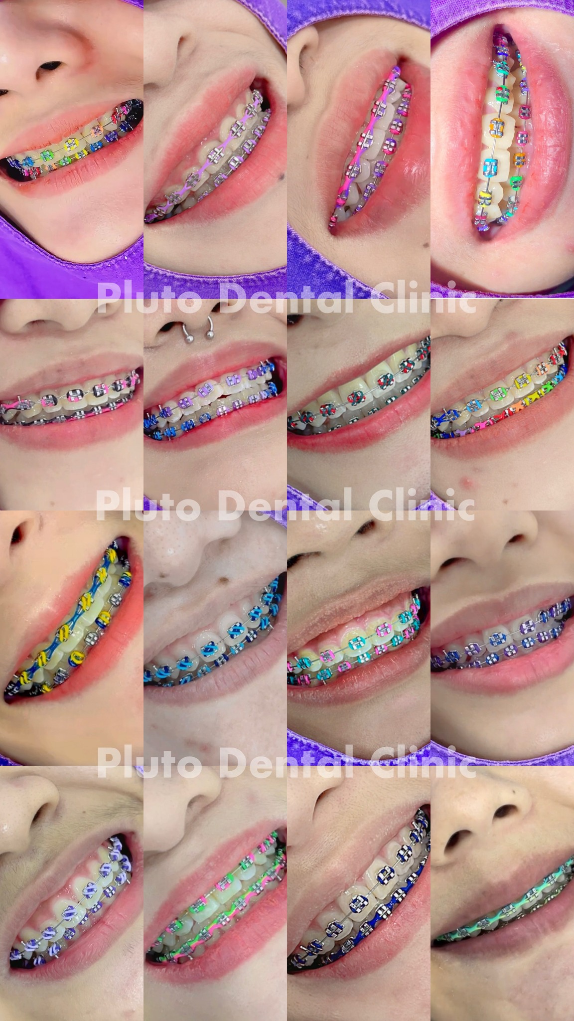 Pluto Dental Clinic Facebook ad