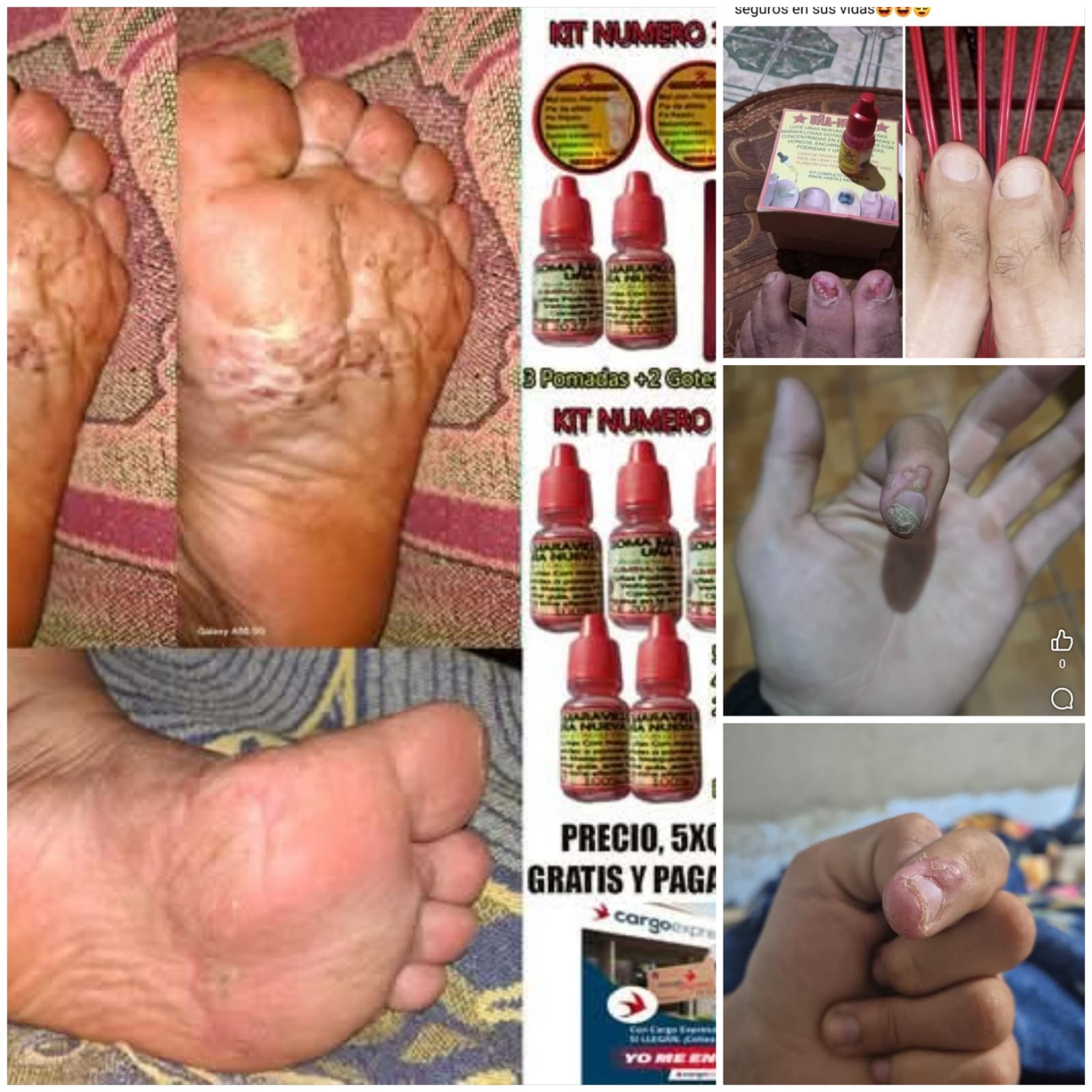 Callo-Derma Guatemala Facebook ad: HONGOS, MAL OLOR, COMEZON, MEZQUINOS?