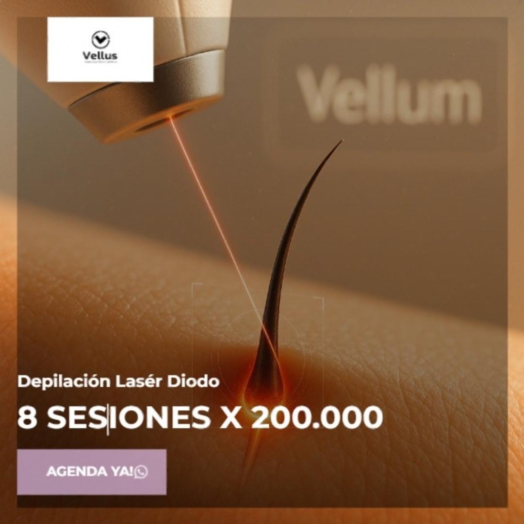Vellus Facebook ad