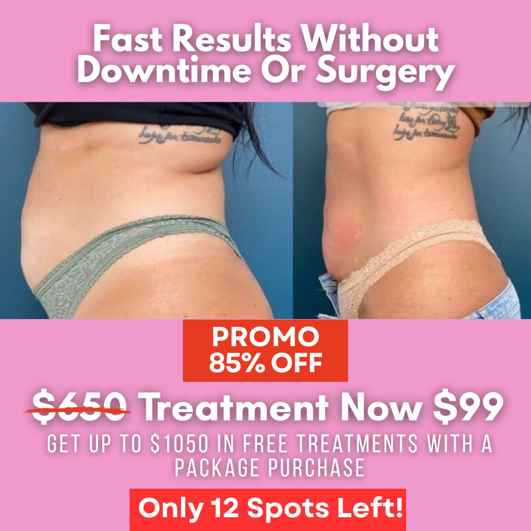 Body Techs Rx Wellness + Rehab Center Facebook ad