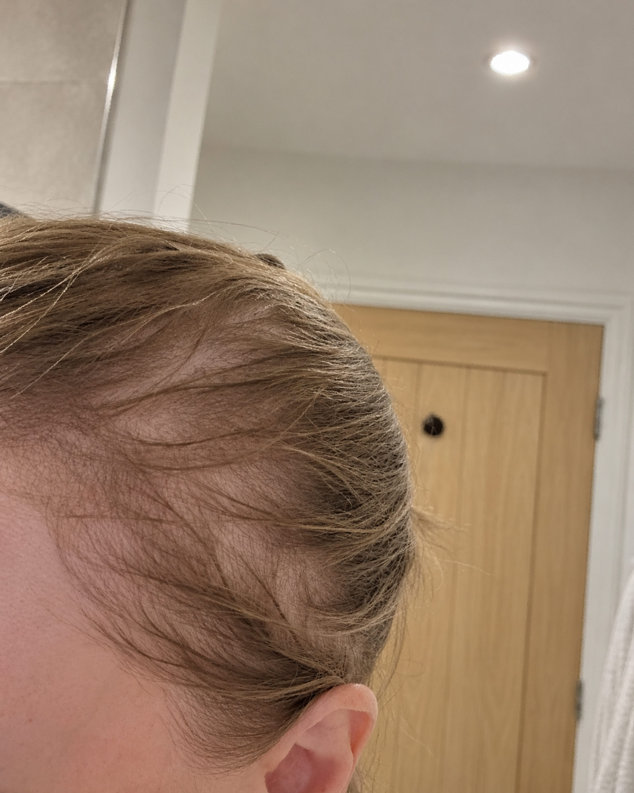 Dr. Patricia Sullivan Facebook ad: The reason why my patient was losing her hair