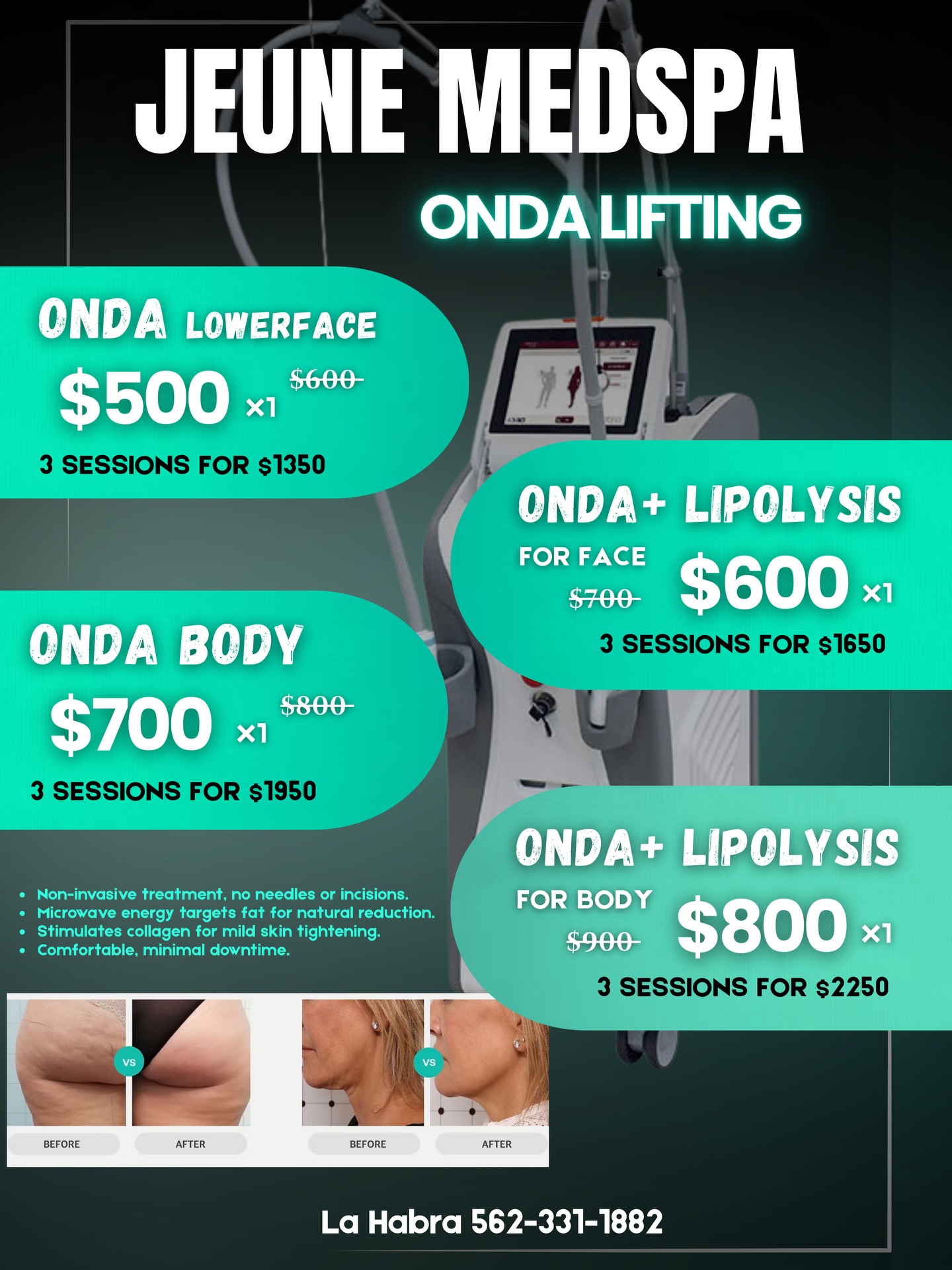 Jeune MedSpa Facebook ad: Instagram