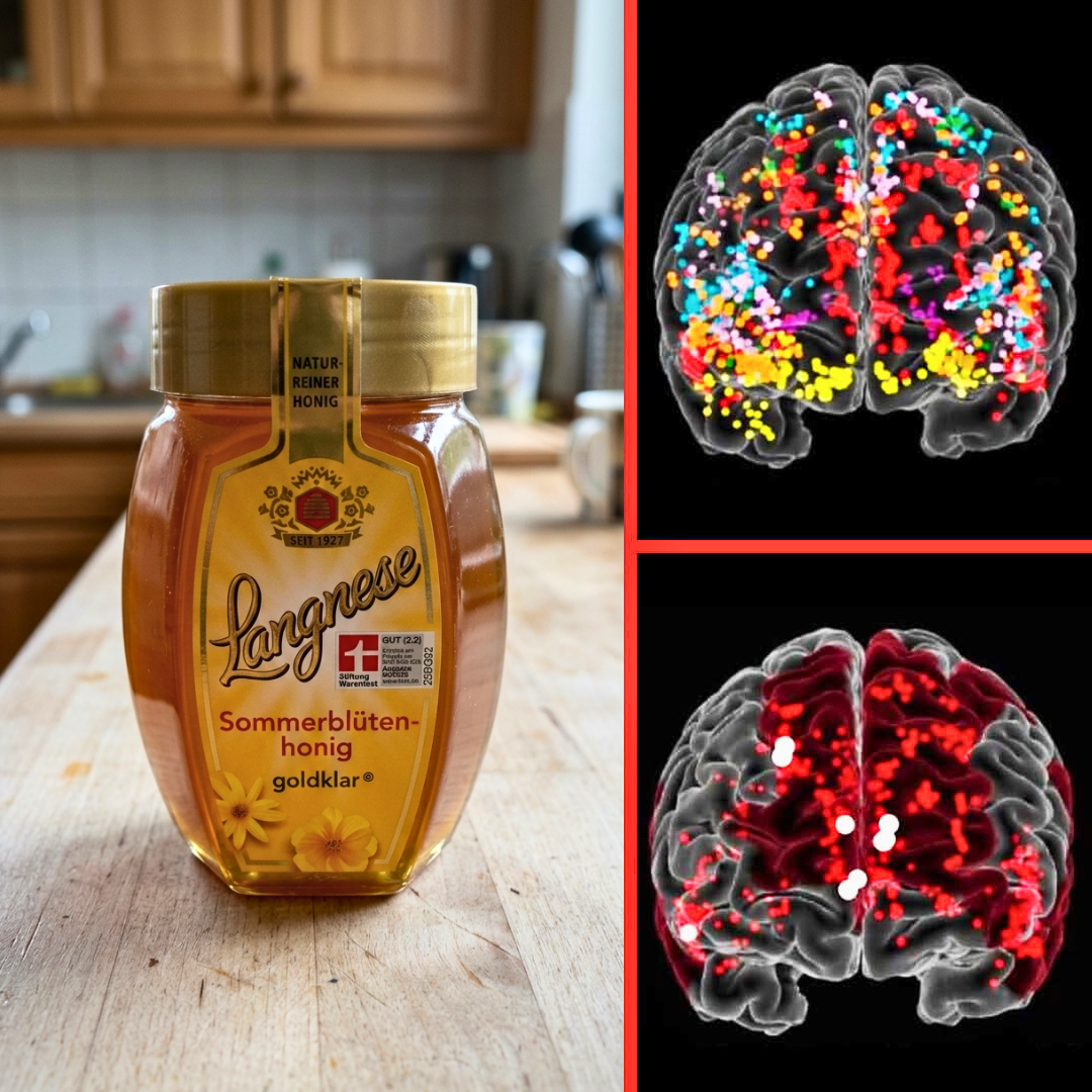 Sophia Evans Facebook ad: Alzheimer-Abbau verlangsamt, dank einer neuen Entdeckung…