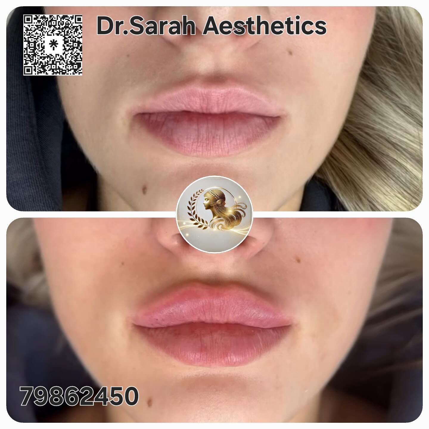 Dr.Sarah Aesthetics Facebook ad: Perfect, Plump, and Natural-Looking Lips!