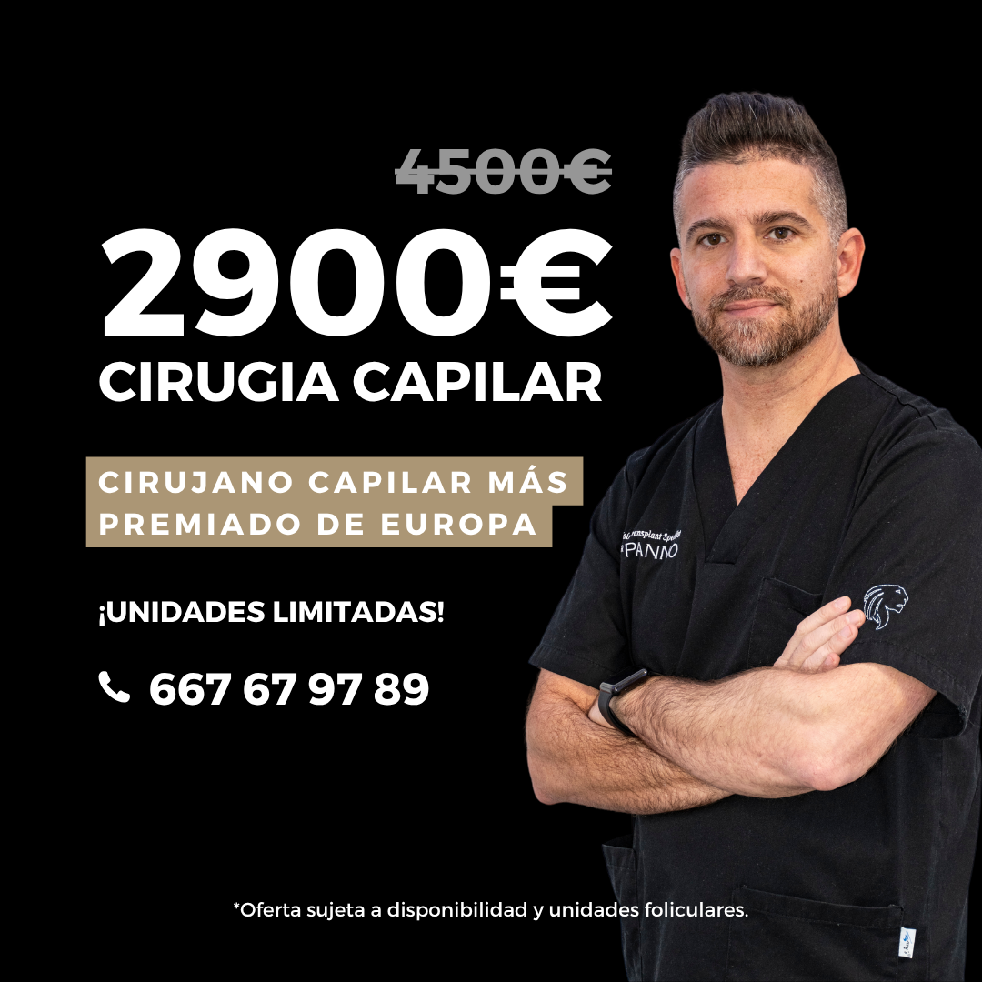 Hair Transplant Malaga Dr. Panno Facebook ad from May 20, 2026