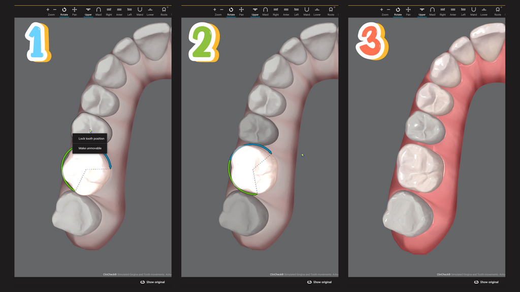 The CLEAR Institute Facebook ad: The Underestimated Power of Molar Derotation in Space…