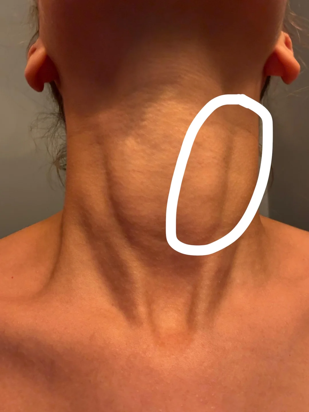 Thyroid Health Daily Facebook ad: Read this if you're scared to take GLP-1