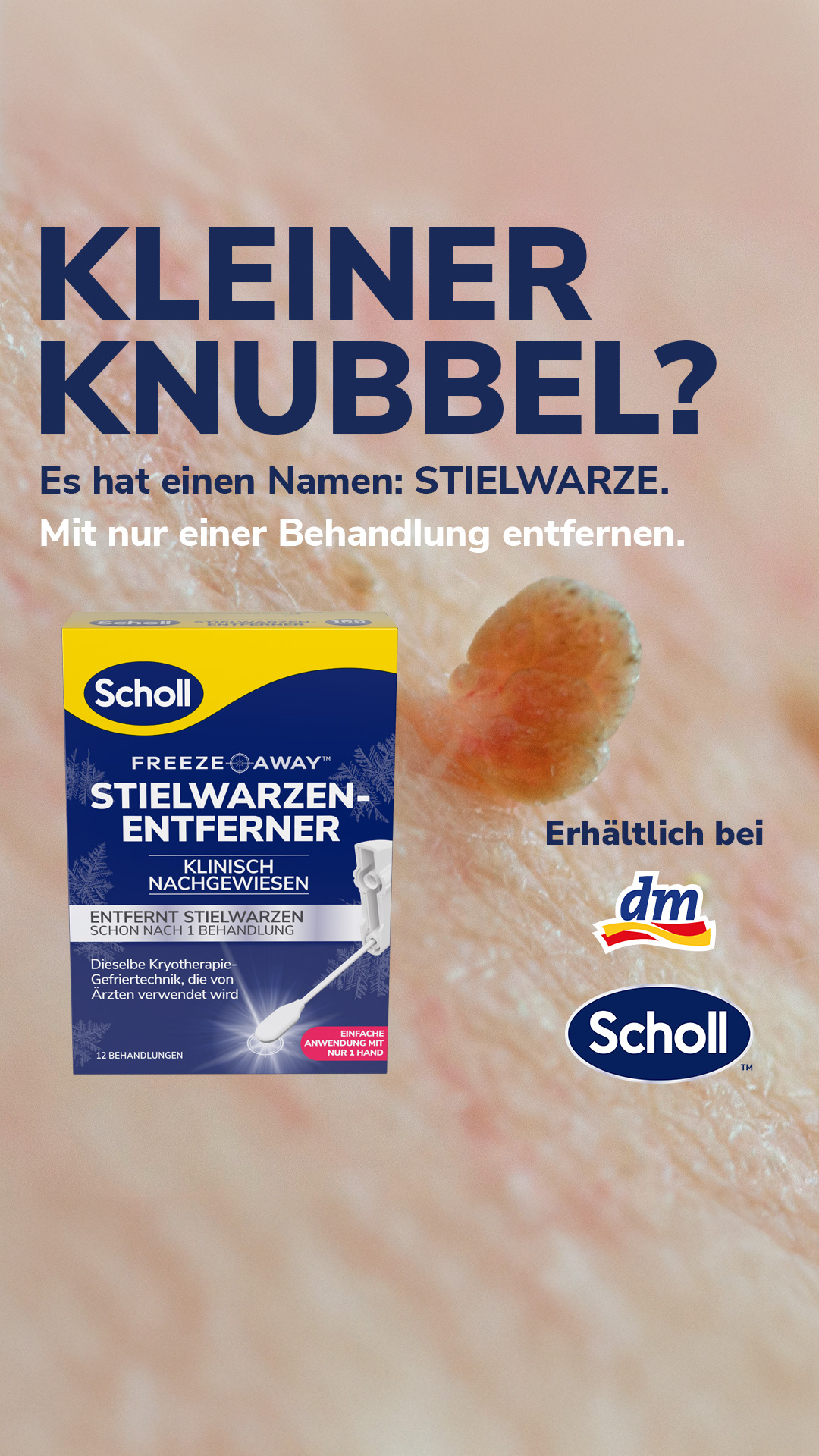 Dr. Scholl’s Fußpflege Deutschland Facebook ad from May 31, 2026