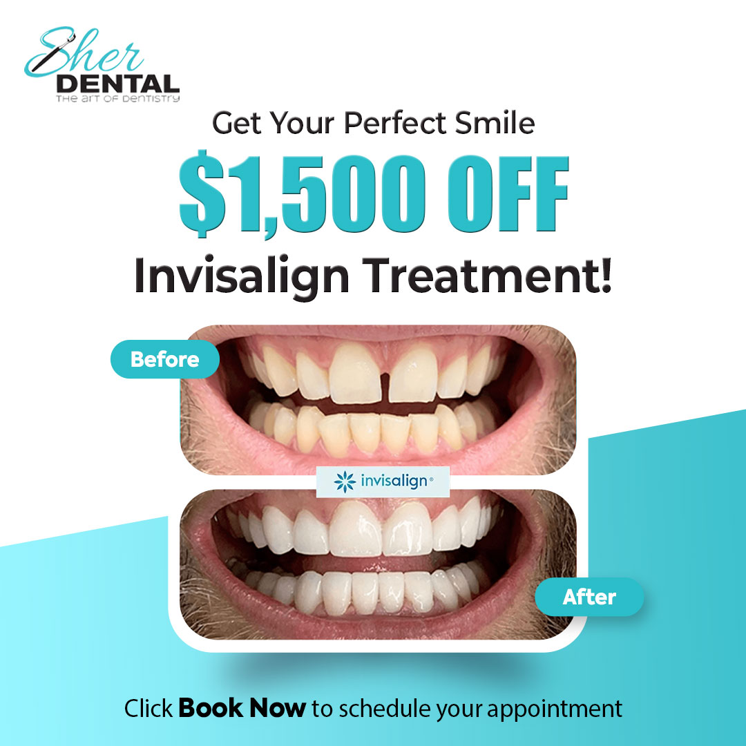 Sher Dental Facebook ad