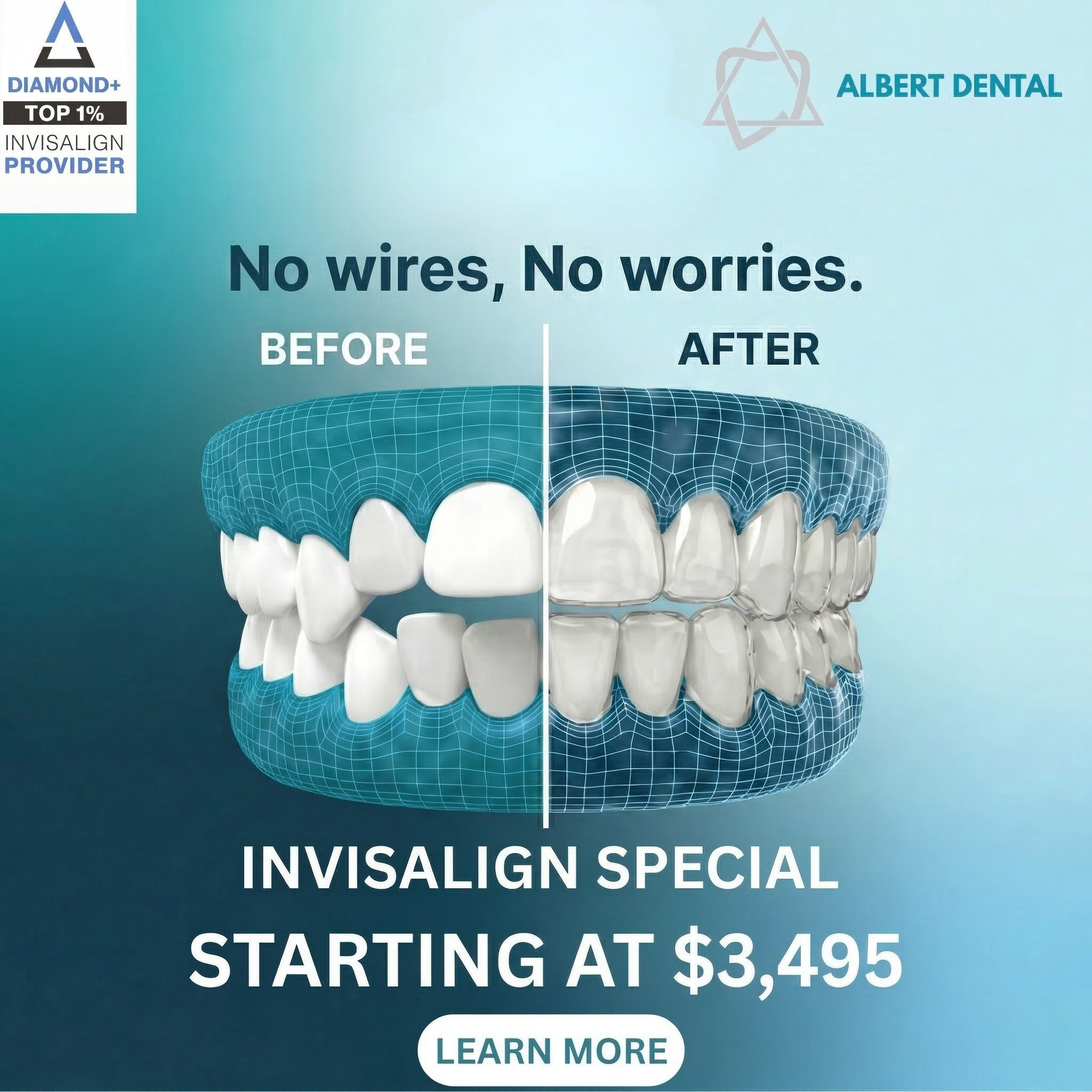 Albert Dental Facebook ad: Hey, Olathe & Overland Park! Invisalign starting At Just…
