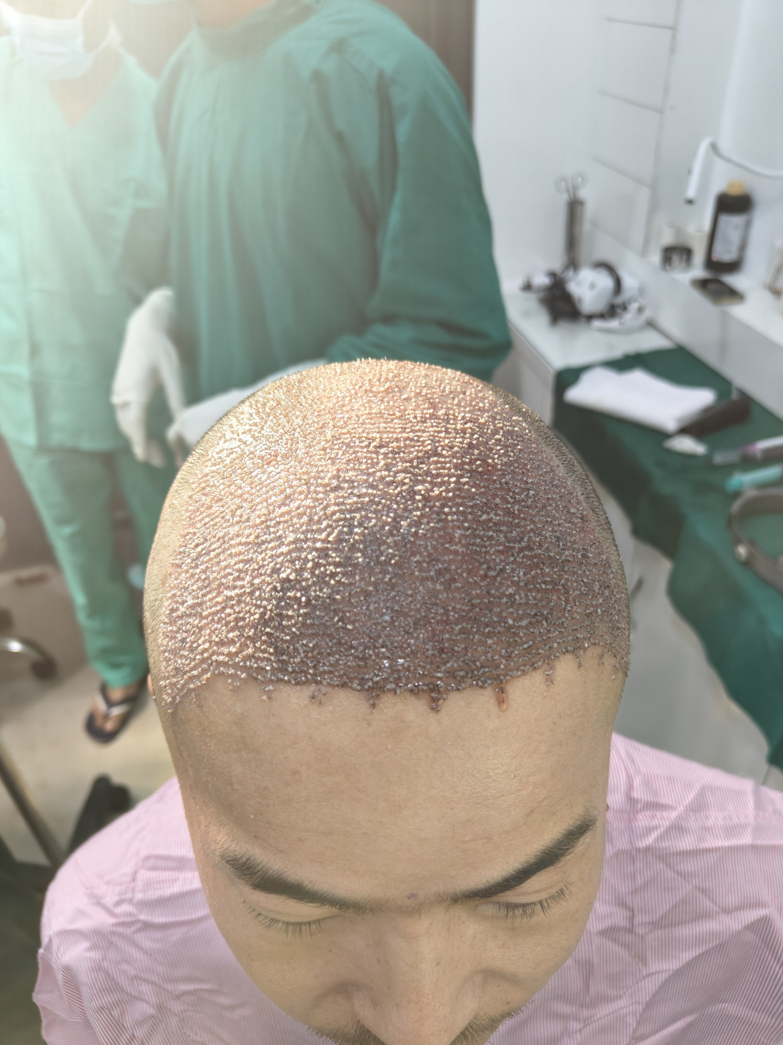 Cult enhance Siliguri & Jaigaon Facebook ad: HAIR TRANSPLANT,LESER HAIR REDUCTION, BUTOX, FILLER, FACE…