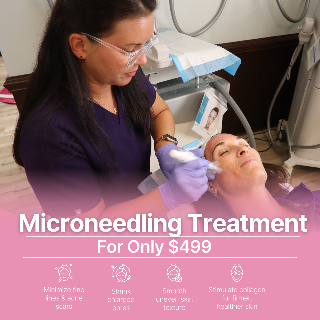 Aesthetically Yours Facebook ad: $499 PRP Microneedling Treatment!