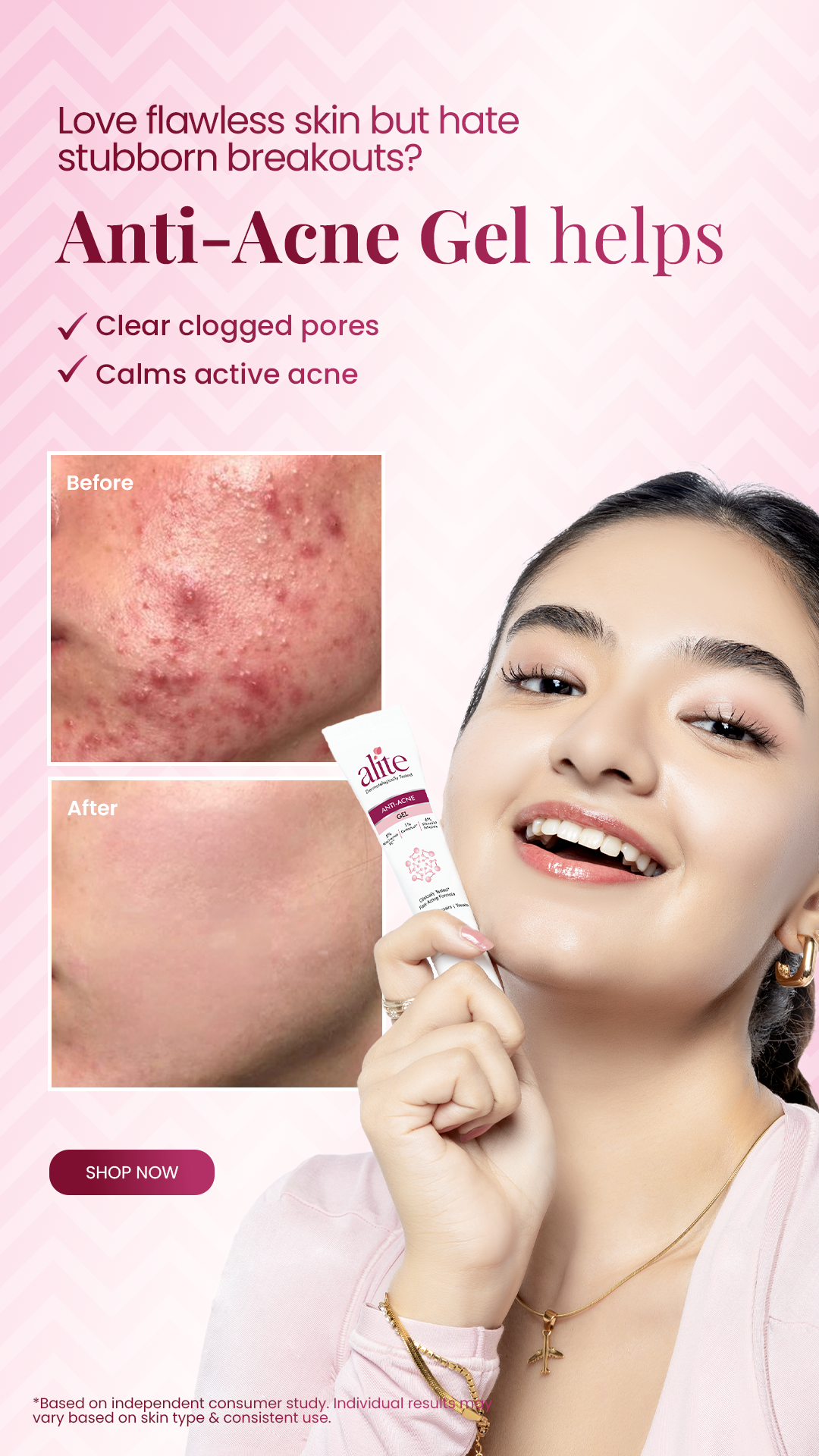 Anushka Sen Facebook ad: Calm Breakouts & Clear Pores Fast