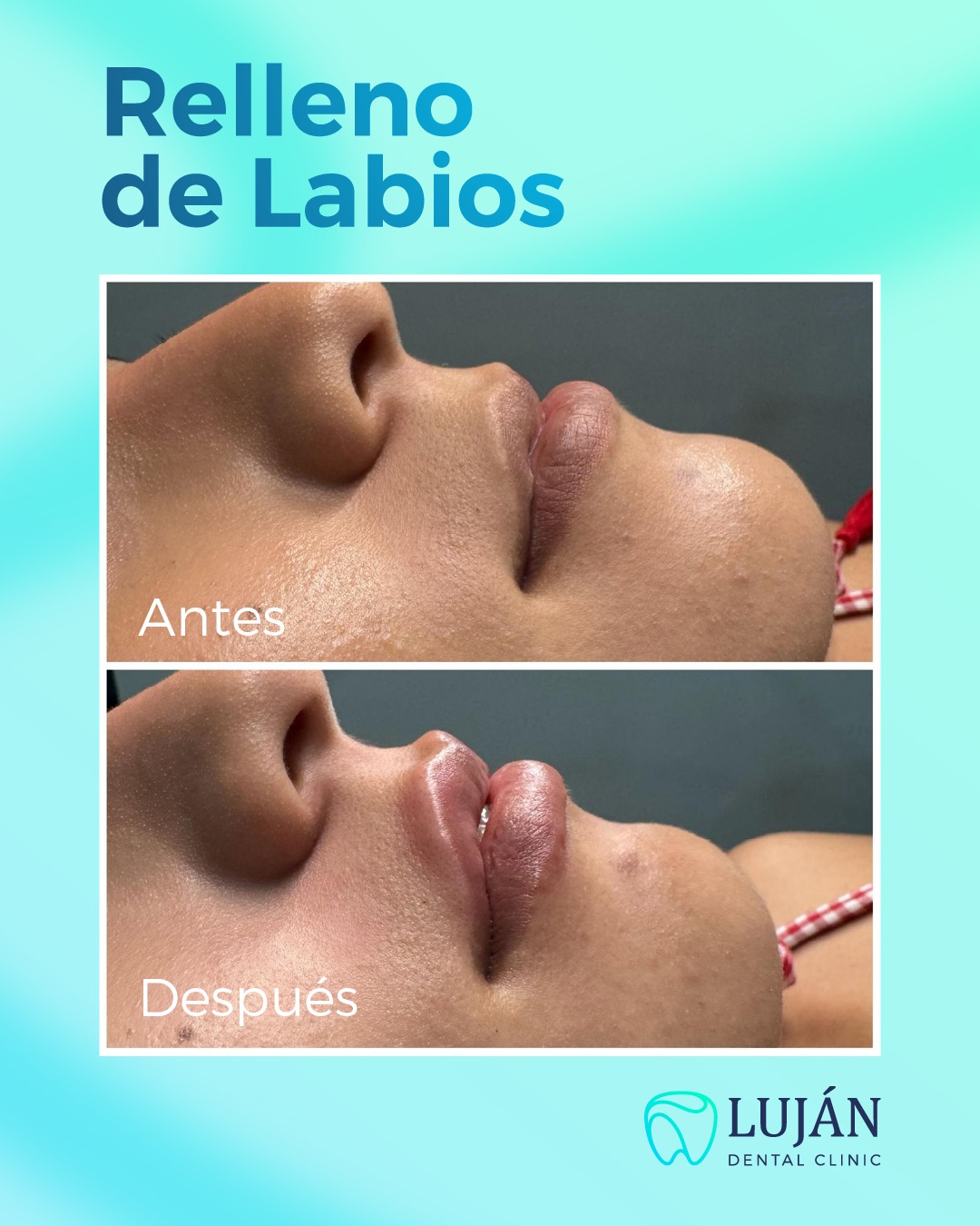Luján Dental Clinic Facebook ad