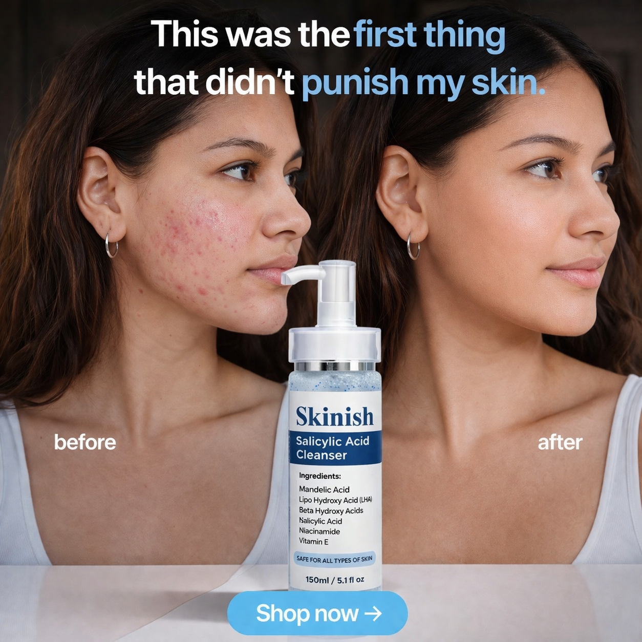 Skinish Facebook ad: Results in 14 days or your money back