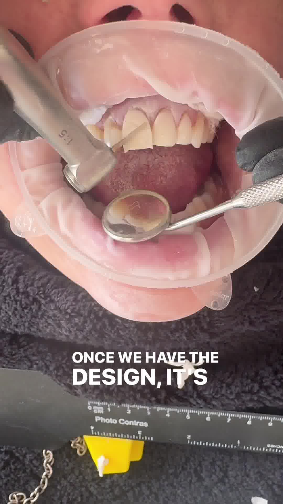 LUME dental Facebook ad: Your new natural smile is waiting for you.