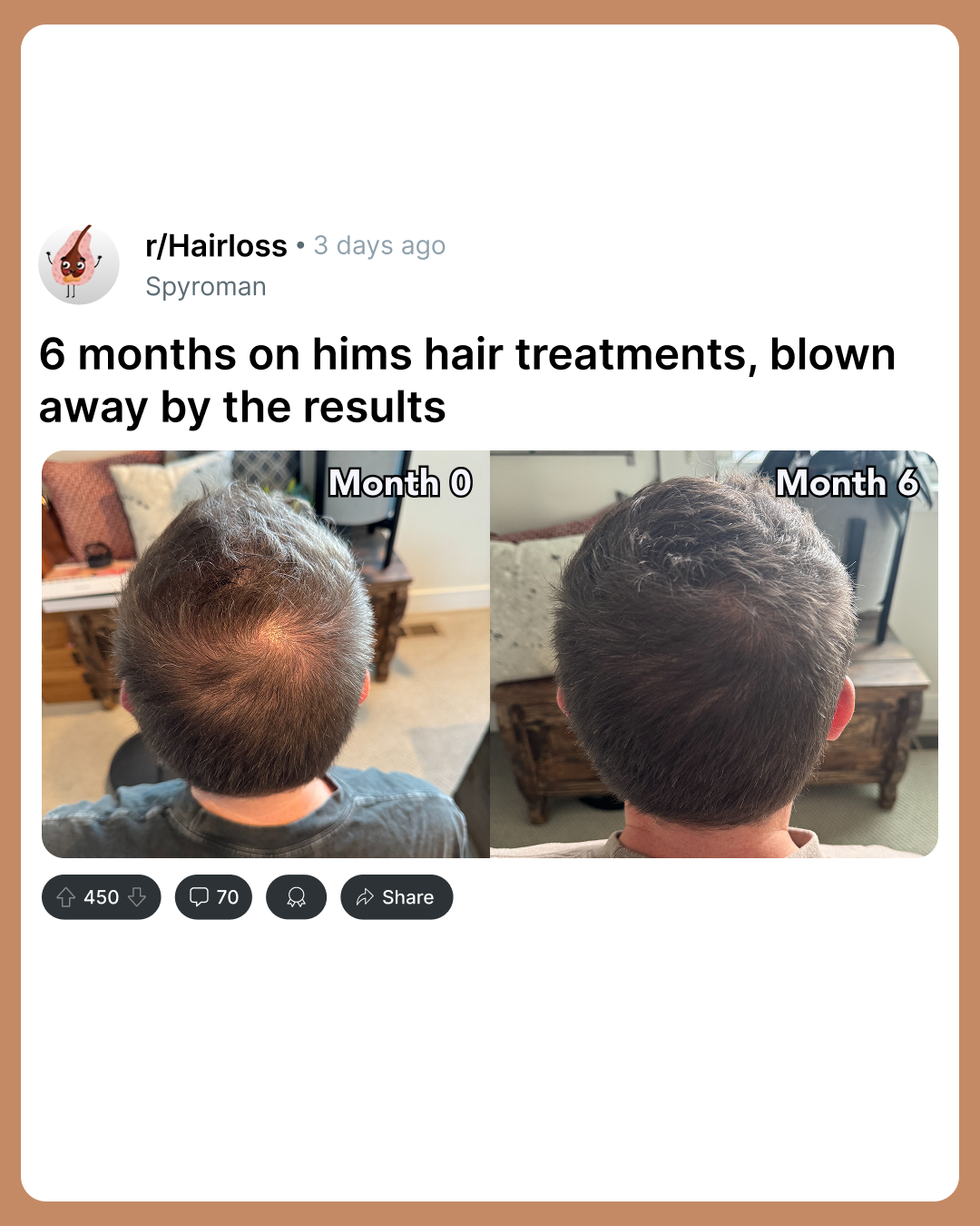 hims Facebook ad