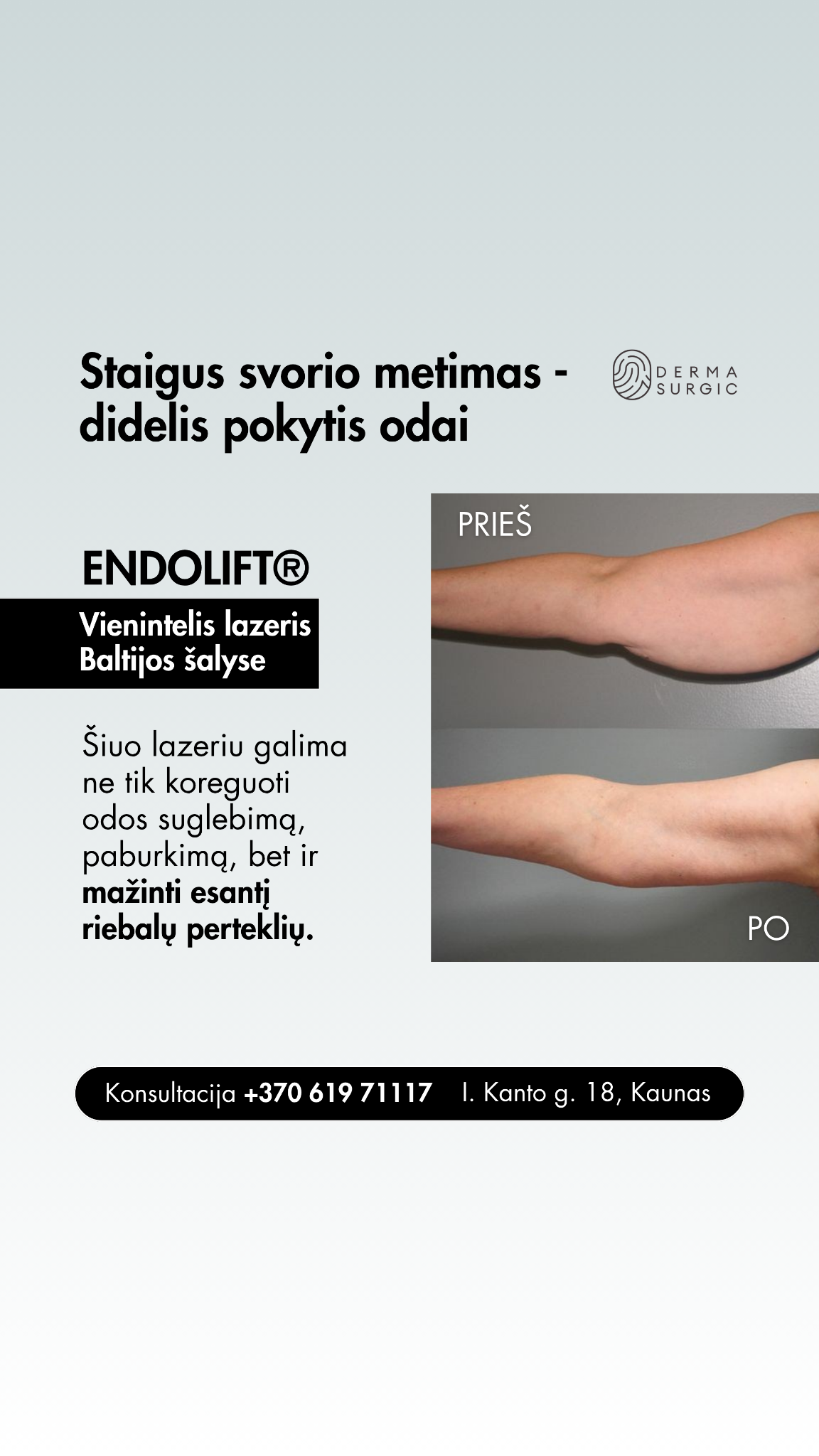 DermaSurgic estetinės medicinos ir chirurgijos centras Facebook ad