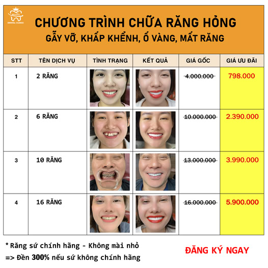 Nha Khoa Melatec Bắc Ninh - Uy Tín, Chất Lượng & Minh Bạch Facebook ad: Miễn phí thăm khám + Chụp X-Quang >>
