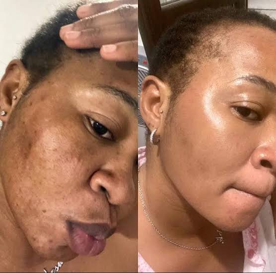 Collagen Sunscreen Facebook ad: BUY @ PROMO PRICE TODAY
