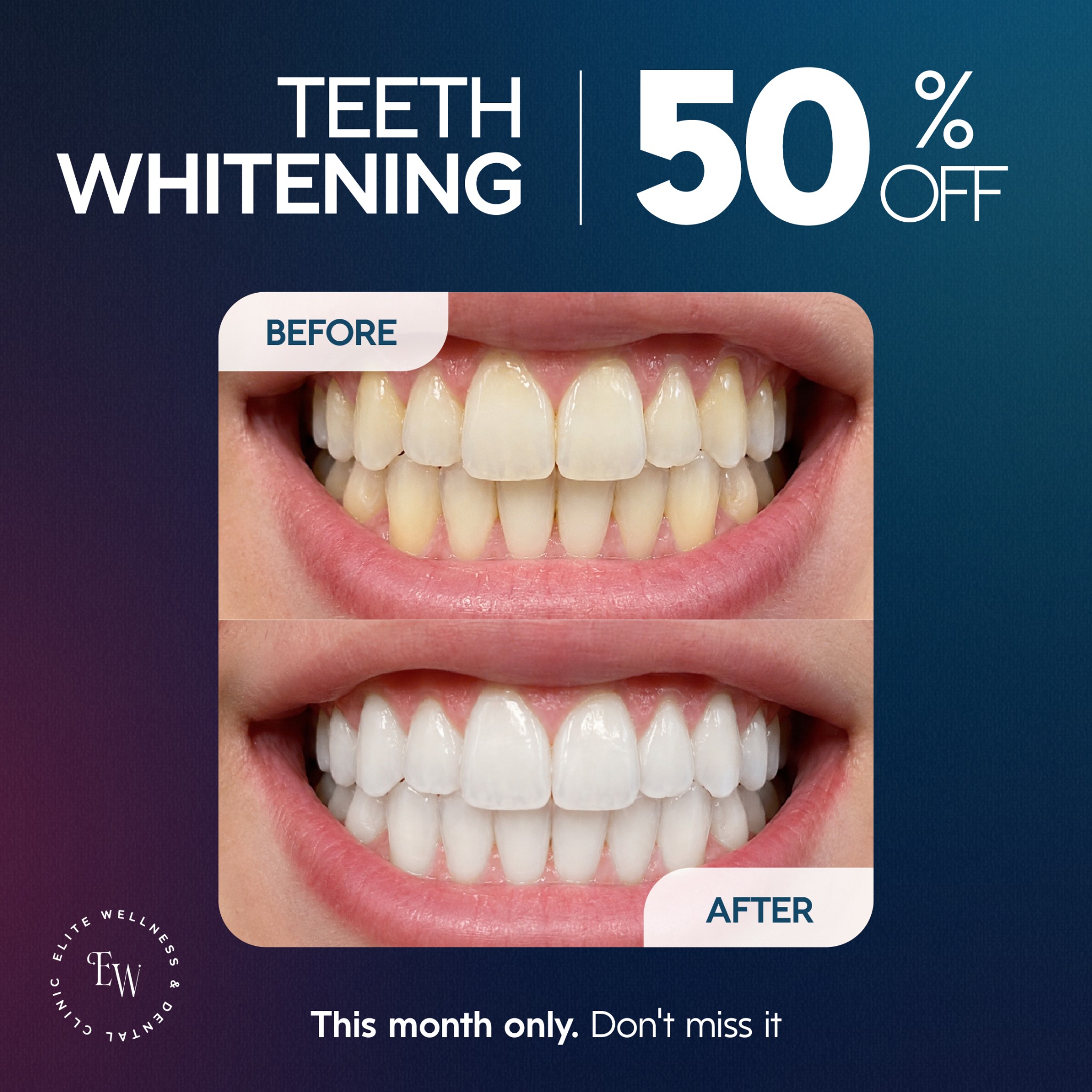 Elite Wellness and Dental Clinic Facebook ad