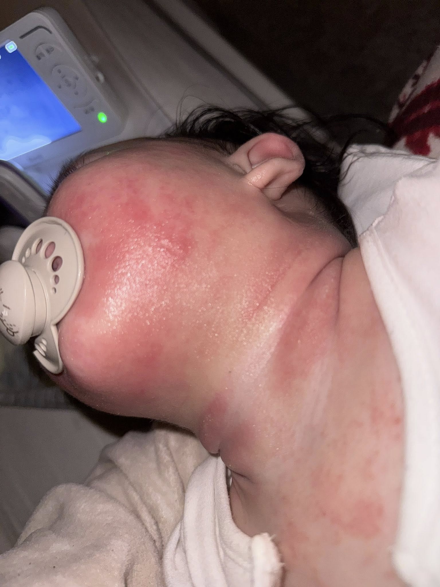 Jessica Rossi Facebook ad: Read this if your baby has eczema