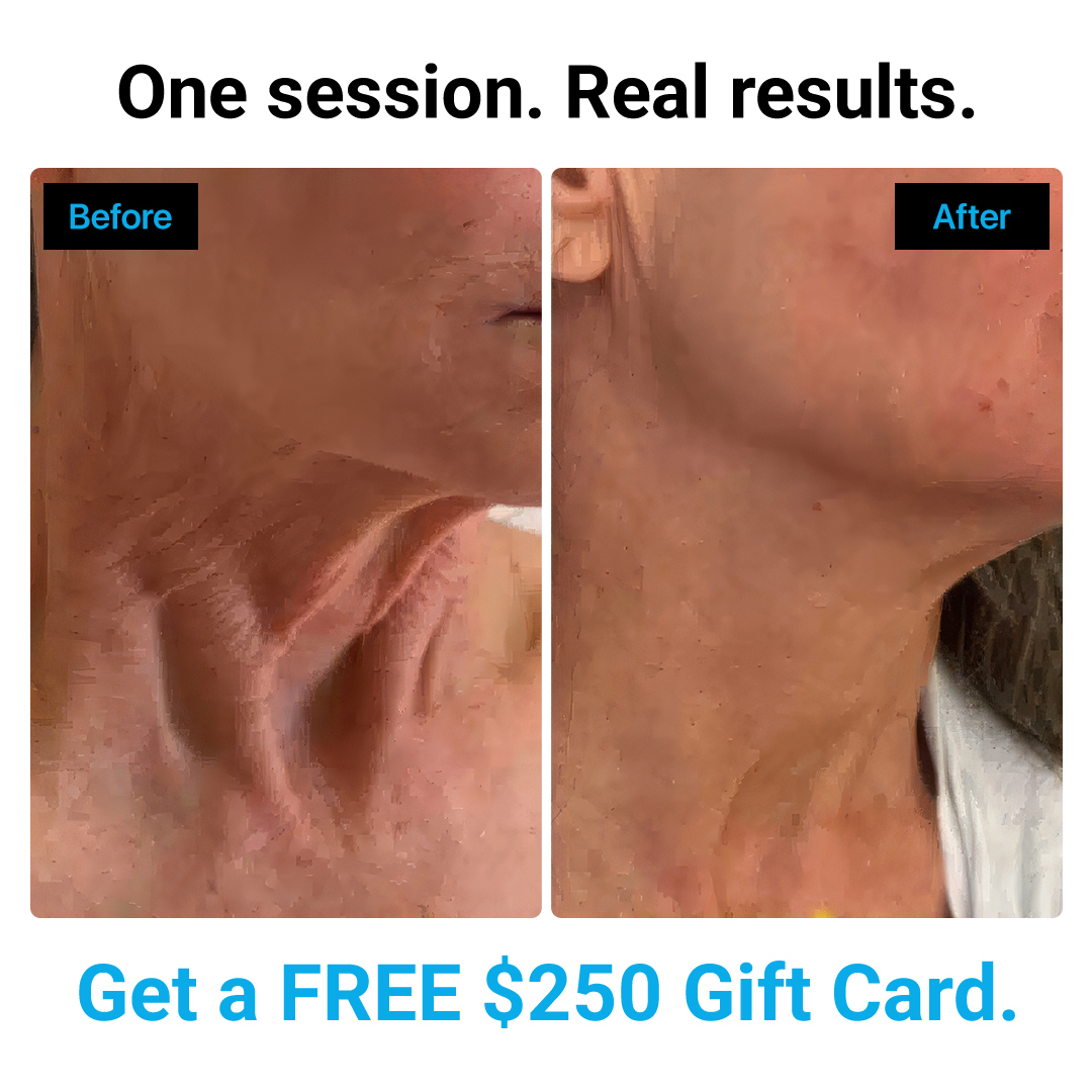 Admire Aesthetics Facebook ad: Tighter Skin Without Surgery
