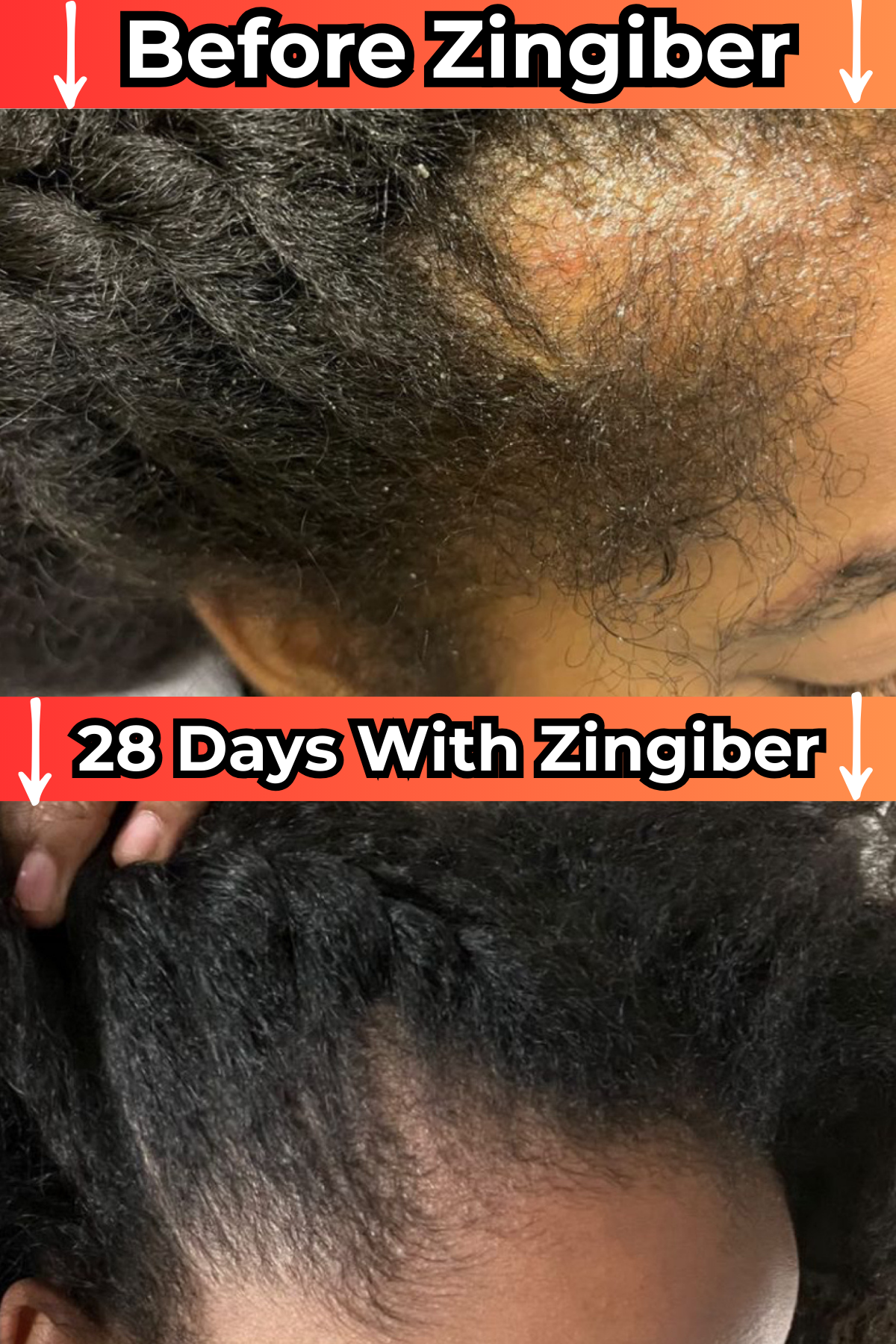 Zingiberhaircare Facebook ad: Use This To Grow Your Edges Back!