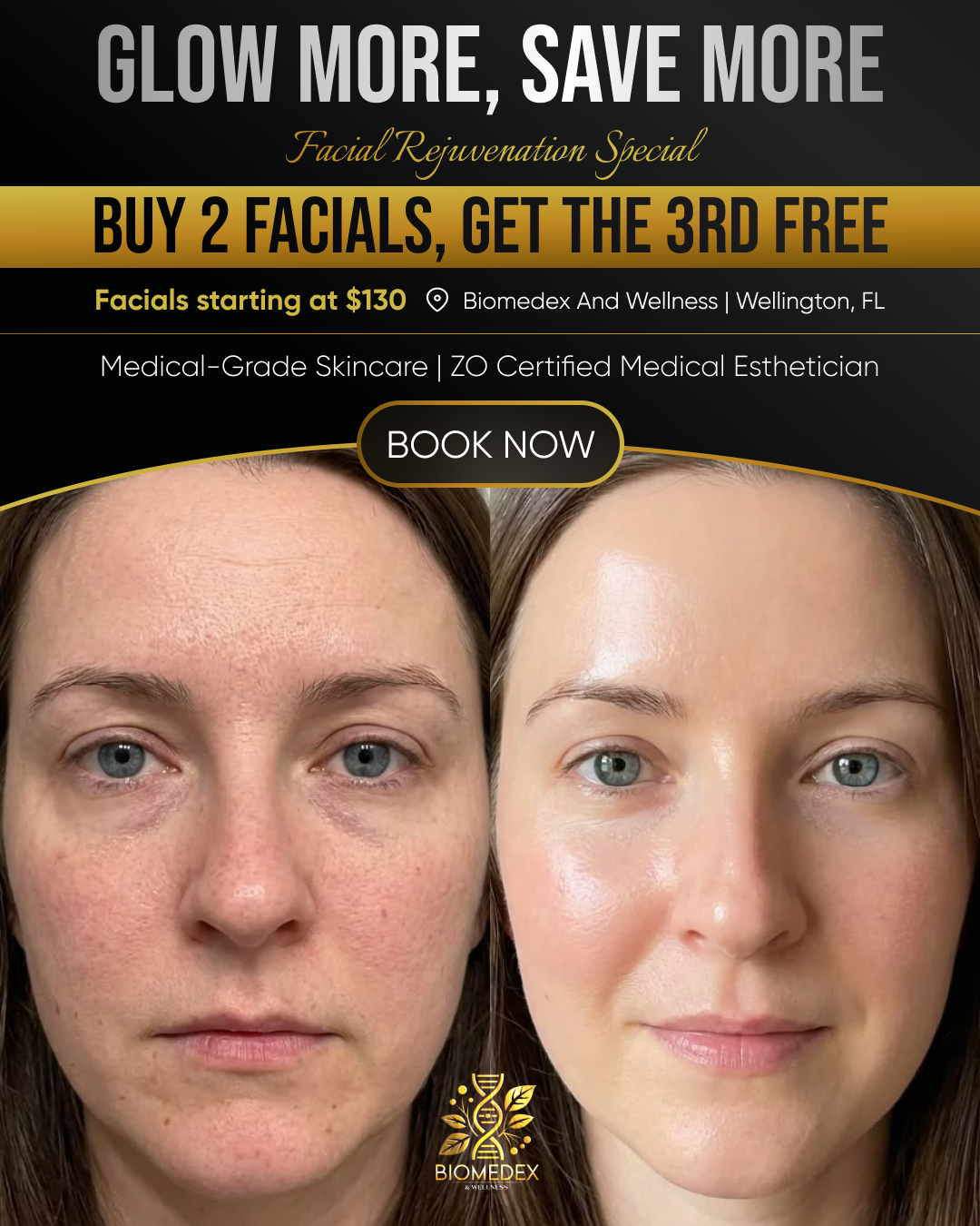Biomedex And Wellness Facebook ad from Apr 14, 2026