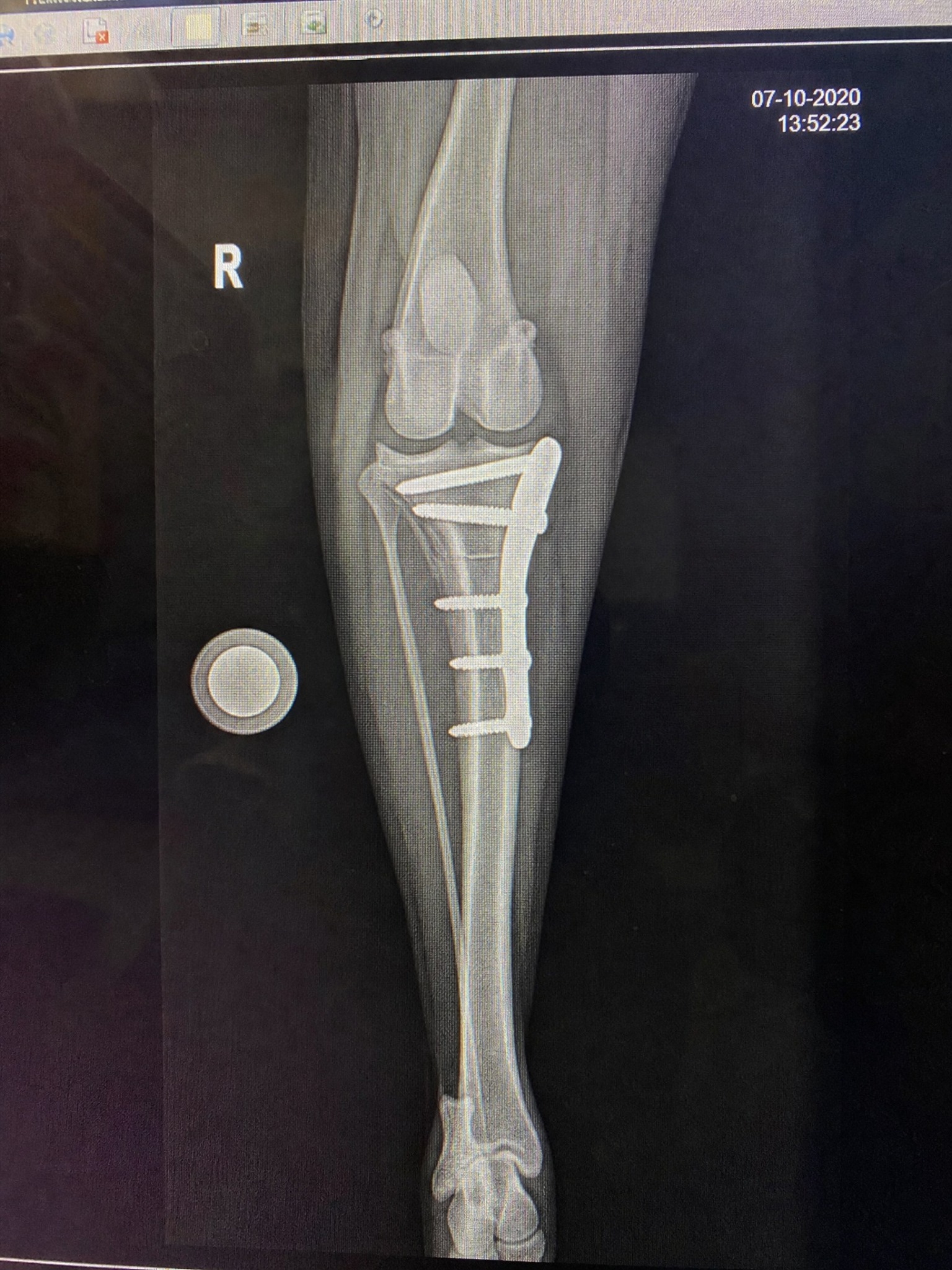 Carol Bennett Facebook ad: Why Your Dog’s TPLO Isn’t Healing.