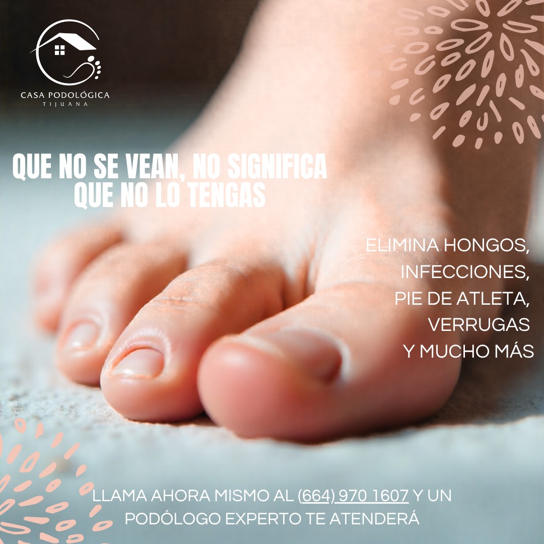 Casa Podológica Tijuana Facebook ad: Tratamiento profesional en Tijuana.