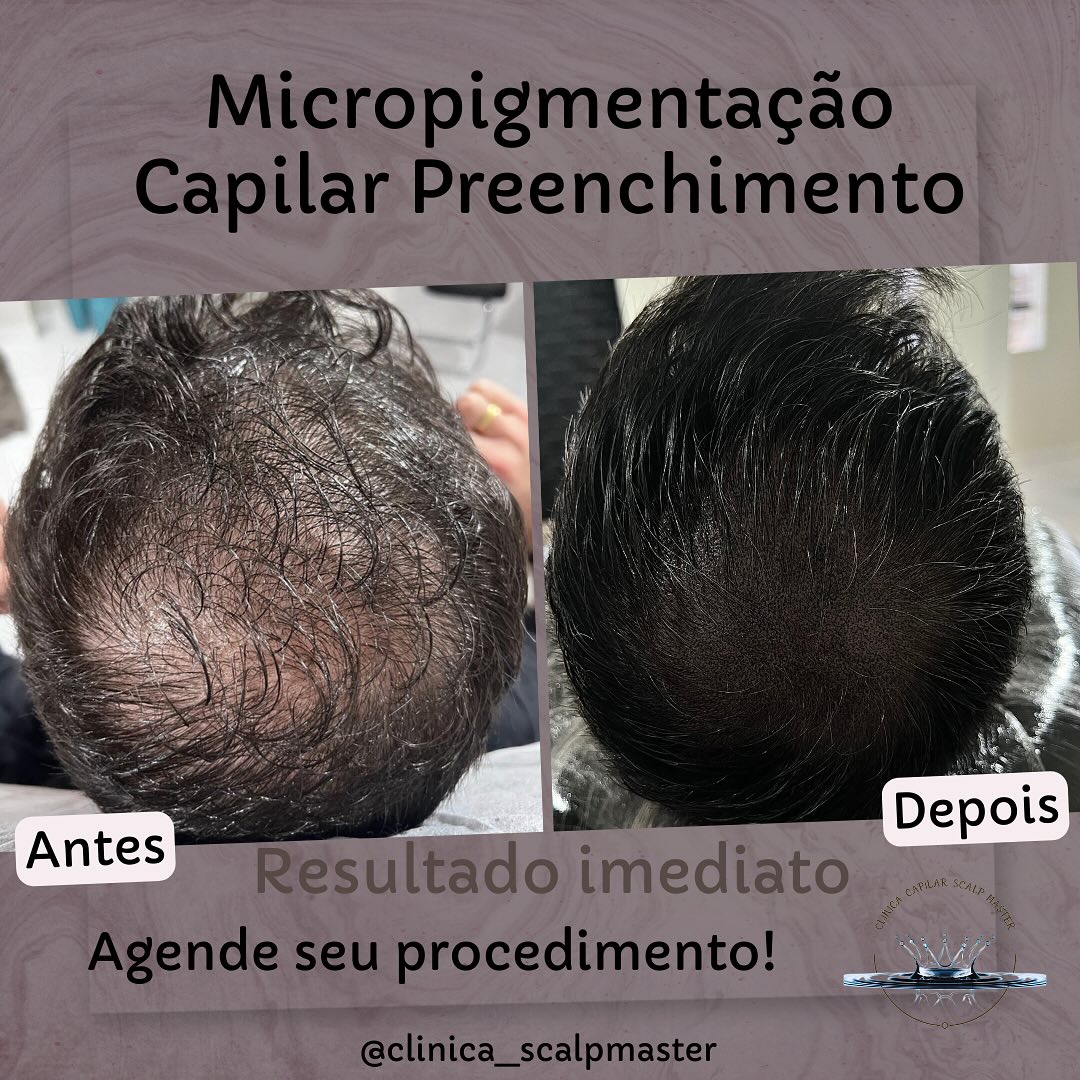 Clinica Capilar Scalp Master Facebook ad