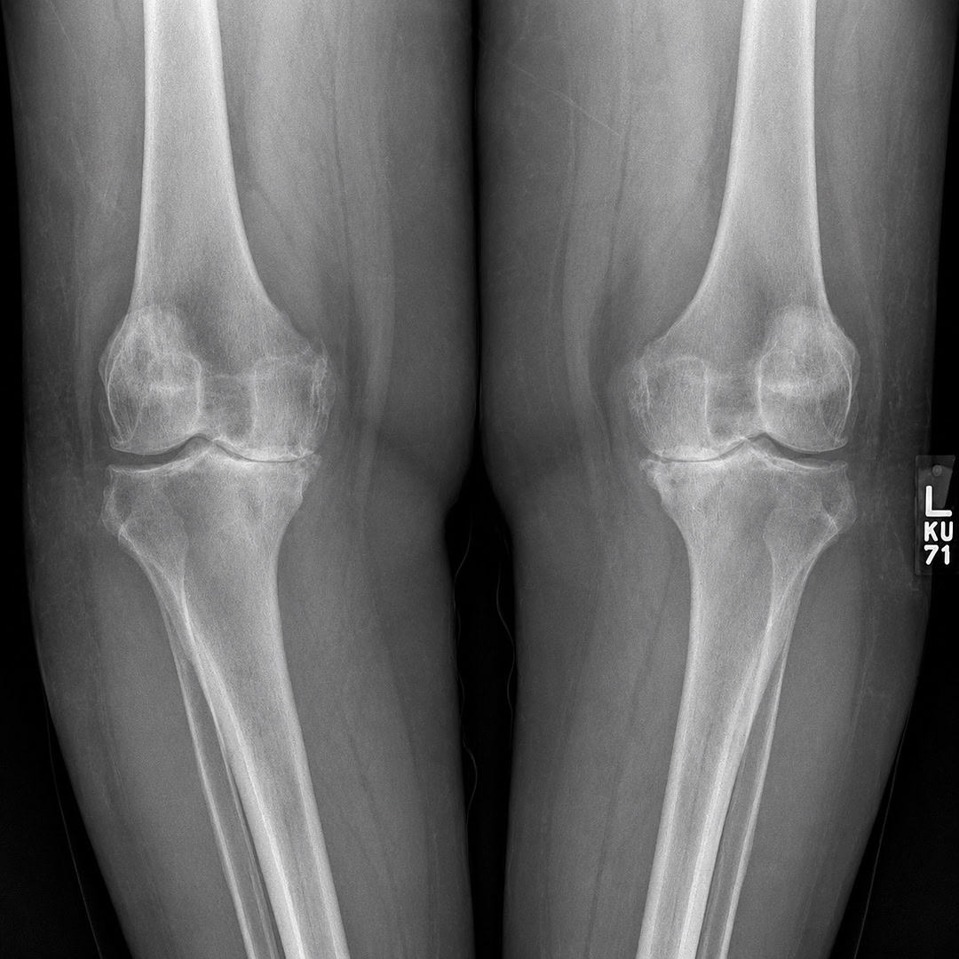 SurgeryMagazine Facebook ad: Read This If Knee Pain Is Stealing Your Life