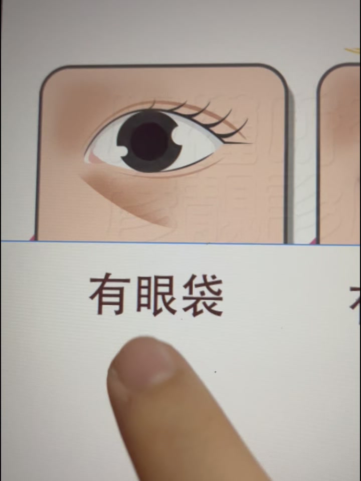 SkinDae Facebook ad: 30天用了无效，退全款给你！