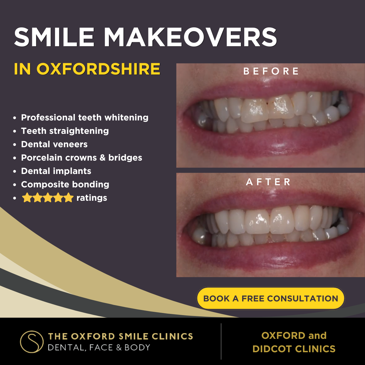 The Oxford Smile Clinics Facebook ad: Smile Makeovers In Oxfordshire