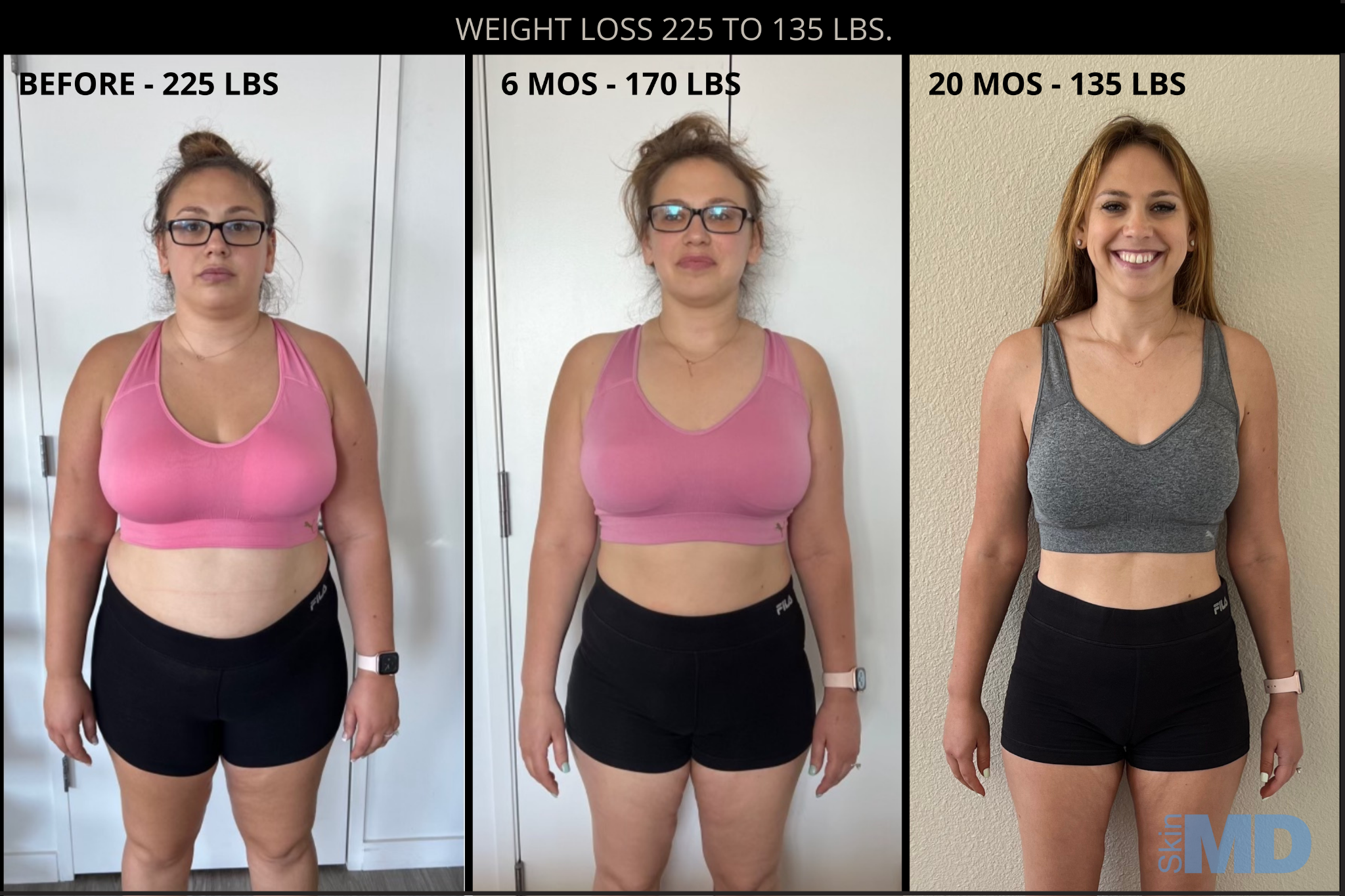 Skin MD Facebook ad: Unlock Your Dream Body Now!