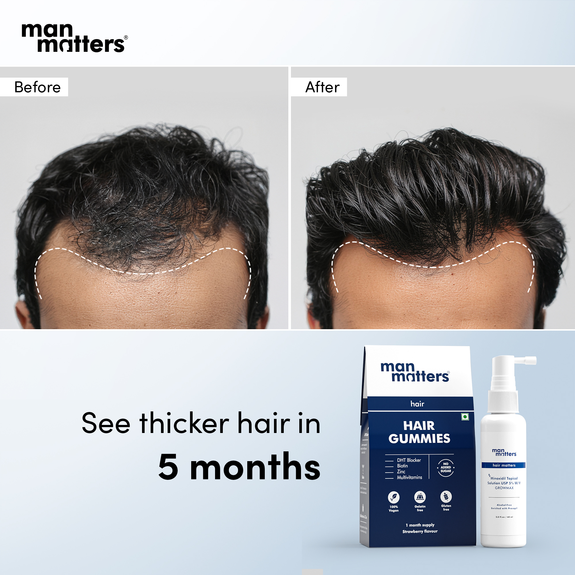 Hair Matters by Man Matters Facebook ad