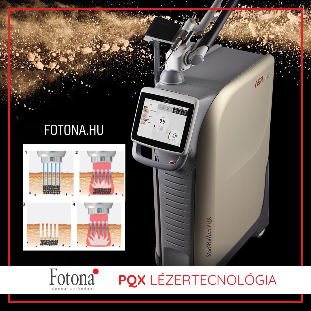 Fotona Lézerek Facebook ad: FOTONA PQX Lézertechnológia