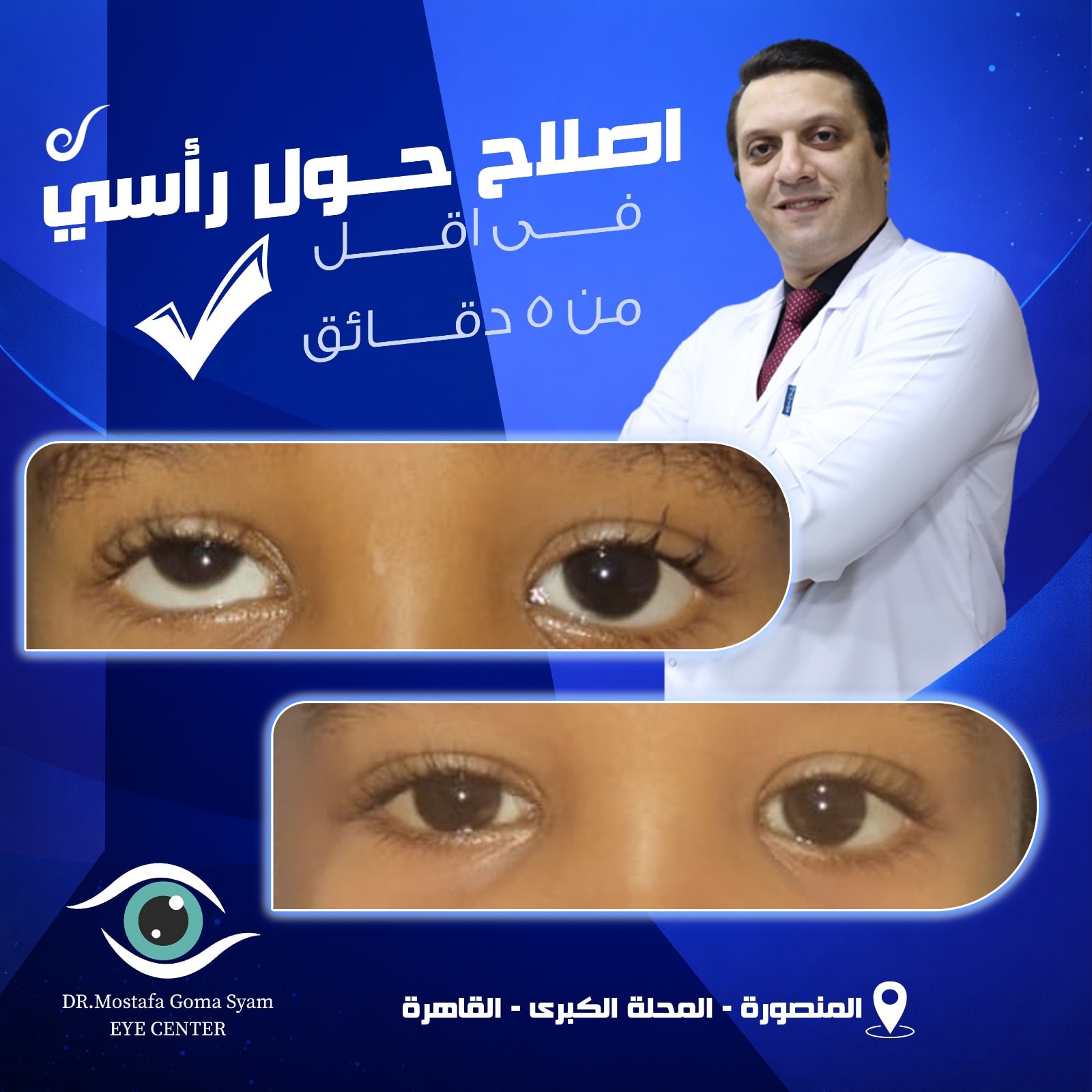 مركز د/مصطفى جمعة صيام لجراحات العيون و الليزك و إصلاح الحول Facebook ad: في اقل من ٥ دقائق اصلاح حول رأسي…
