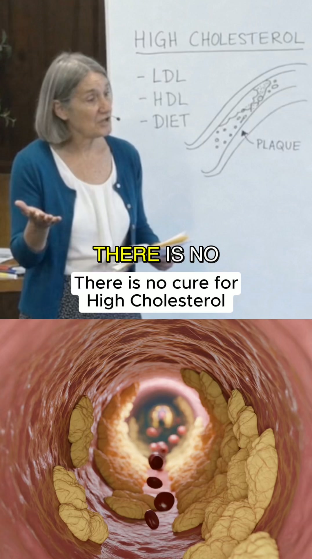 Cholesterol Support Group Facebook ad: Support your liver today